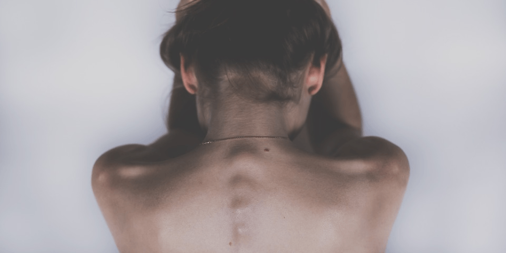 Multiple Sclerosis