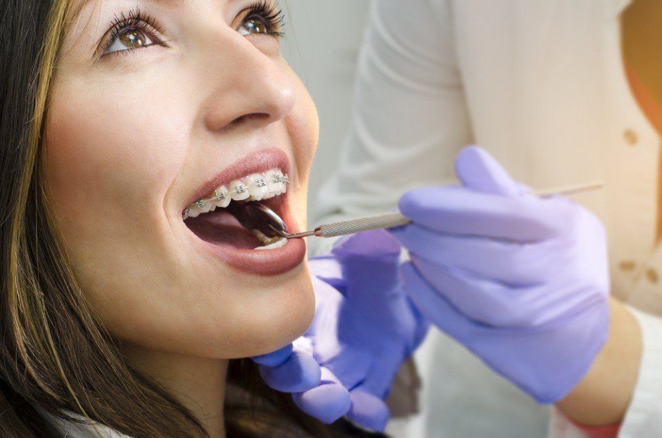 apparecchio per denti