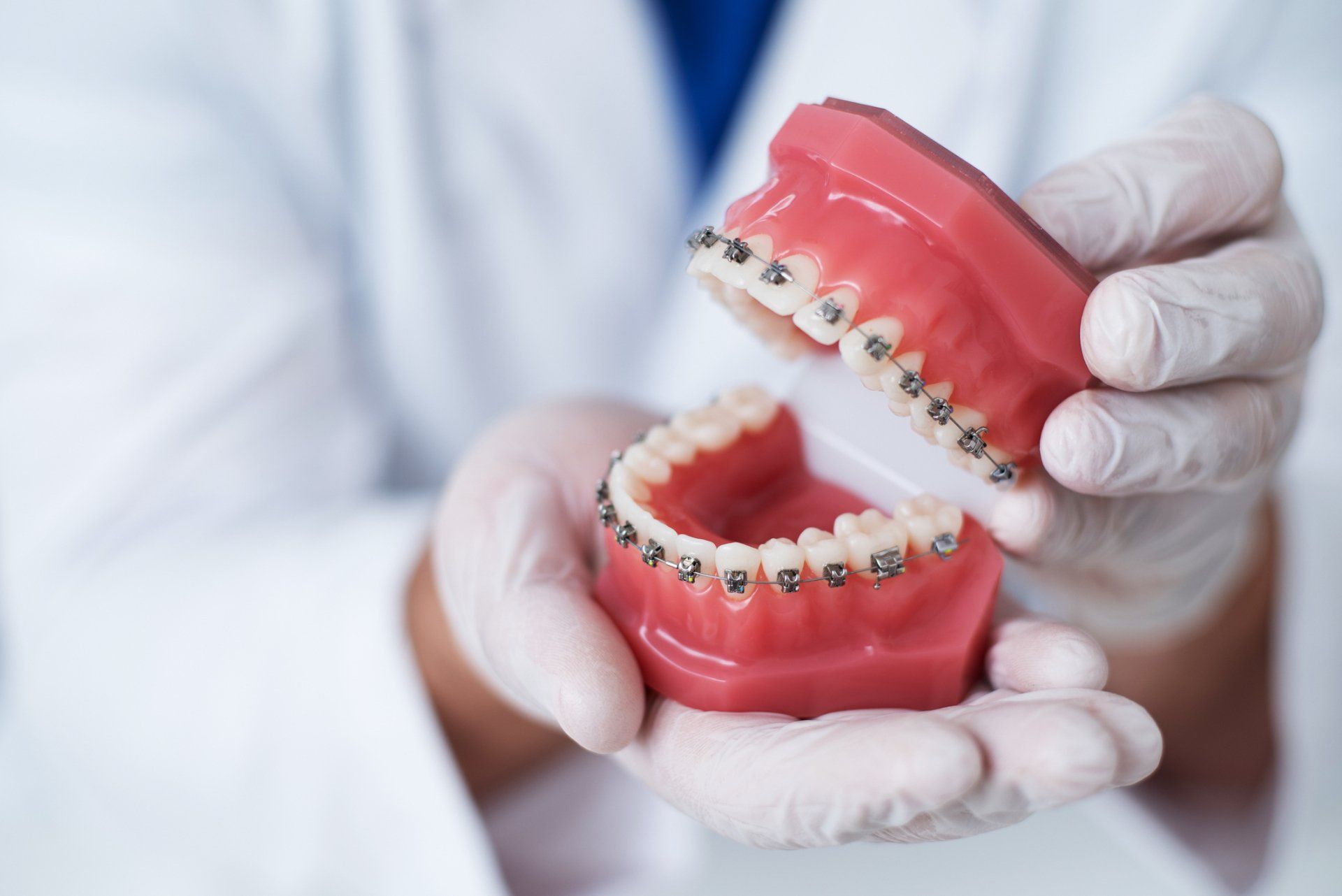 dentiera con apparecchio ortodontico