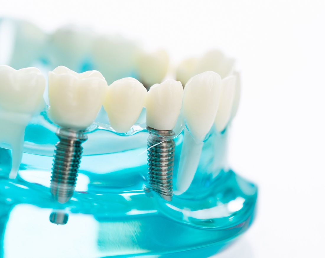 kit di strumenti odontoiatrici