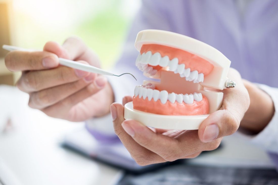modello di arcata dentale inferiore e superiore