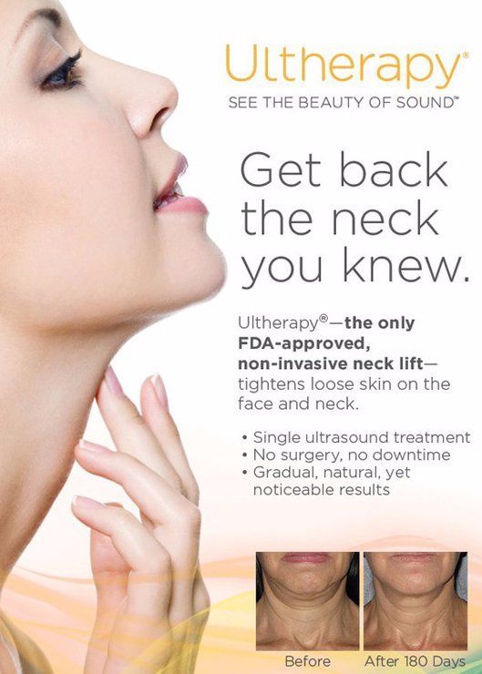 ultherapy