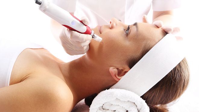 Microneedling