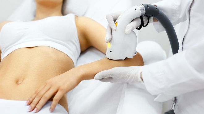 Laser Hair Removal