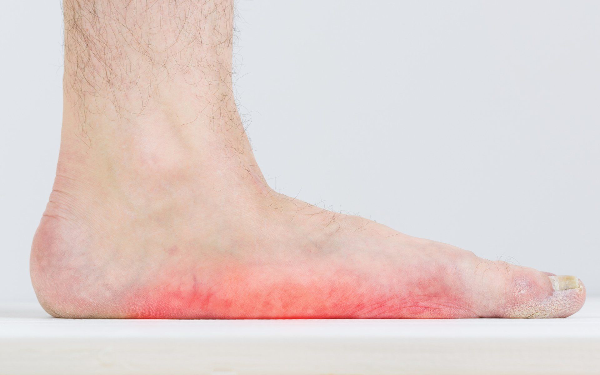 Flat Foot — Garden City, NY — Megan Chapter D.O.