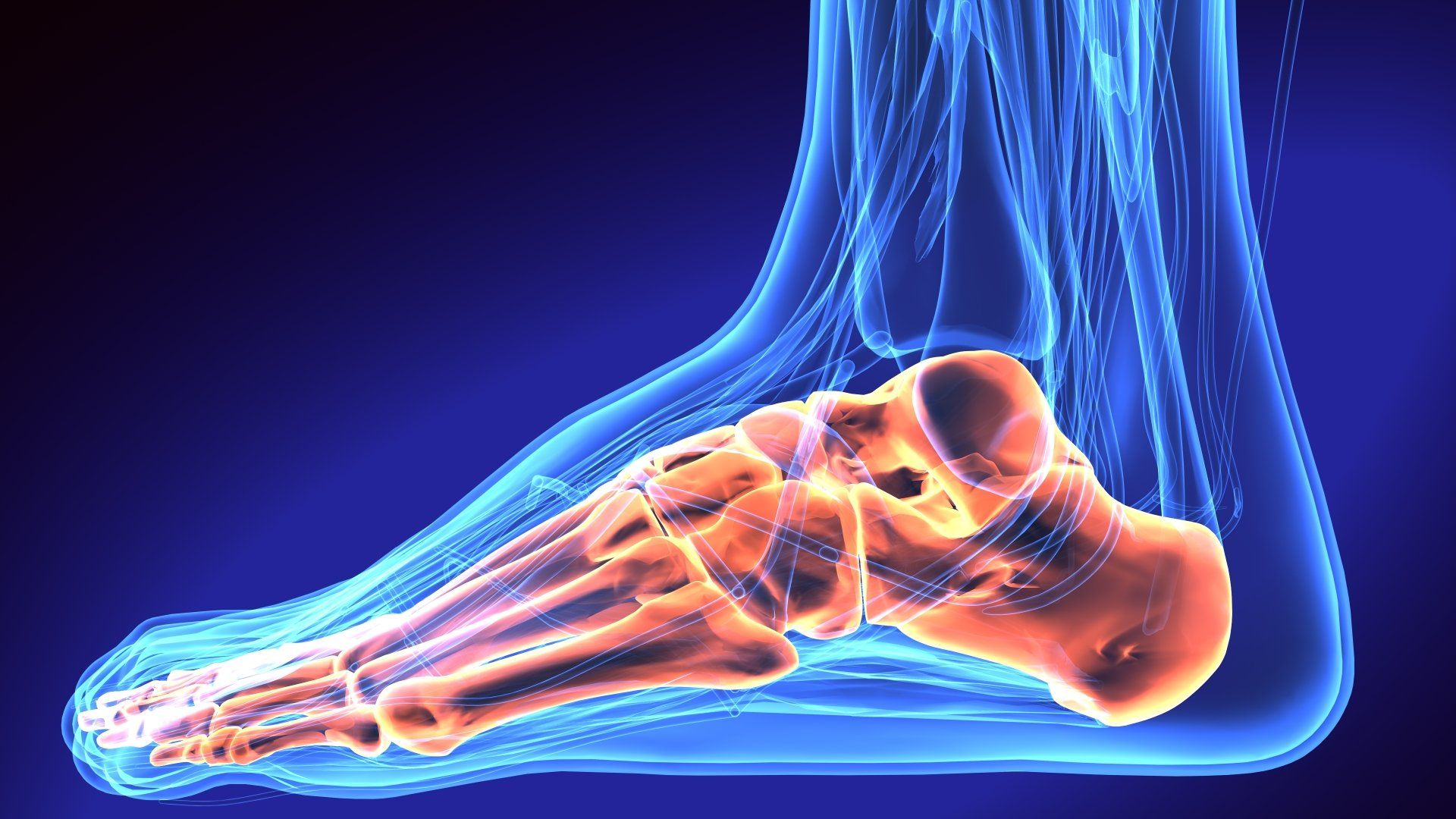 Tarsal Tunnel Syndrome — Garden City, NY — Megan Chapter D.O.