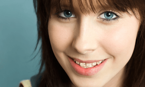 a lady with a smiling teeth and eyes