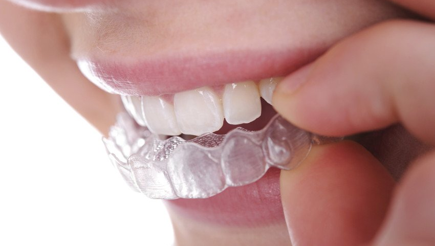 smiling teeth