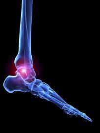 Podiatrist on the Gold Coast