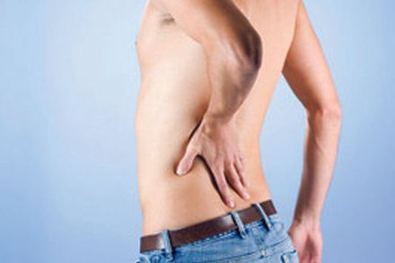 Sciatica