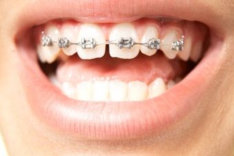 Sealants and More Sealants and More