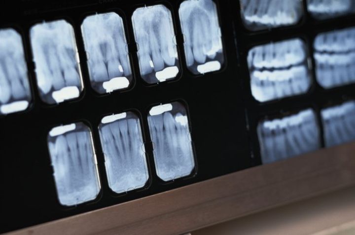 Professional X-Ray Services Professional X-Ray Services