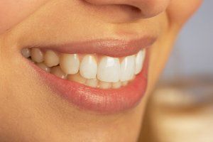Whitening - Including Zoom! Whitening - Including Zoom!