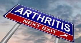Arthritis
