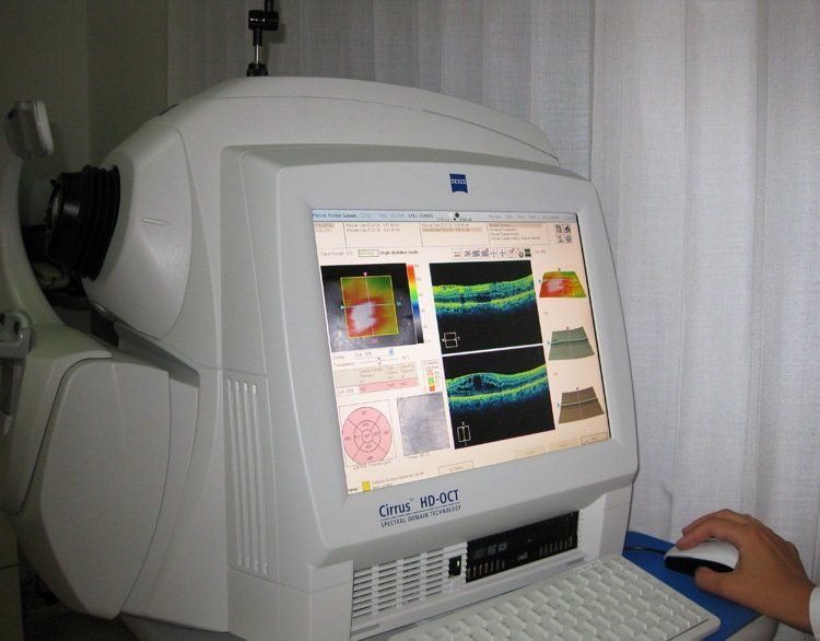 Tomografia a Coerenza Ottica Tomografia a Coerenza Ottica
