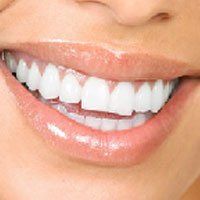 Woman's mouth