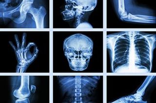 xray - chiropractic in Mechanicsburg, PA