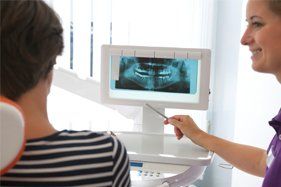 xray of implant patient