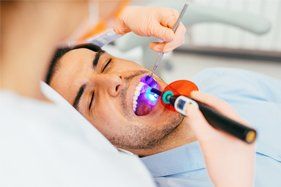 dental sealants