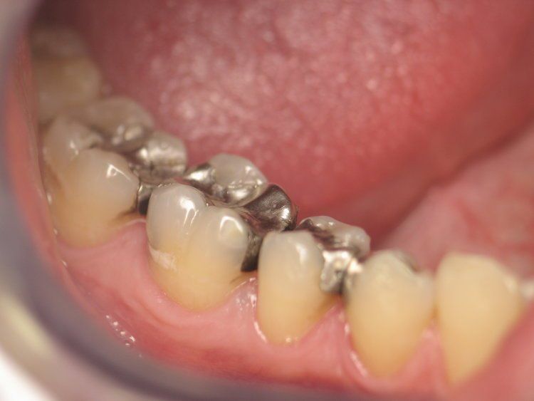 Dental Innovations