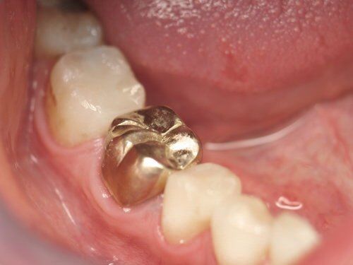 Dental Innovations