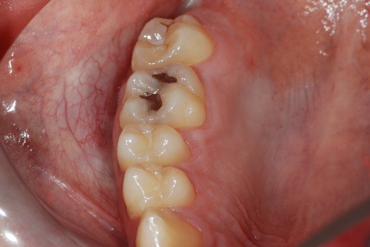 Dental Innovations
