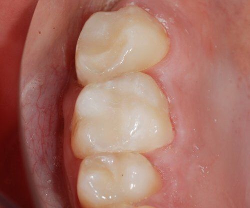 Dental Innovations