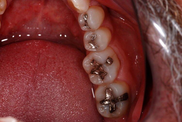 Dental Innovations