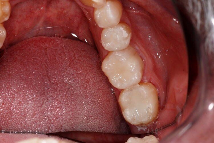 Dental Innovations