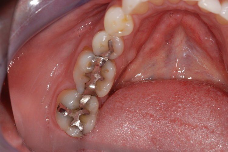 Dental Innovations