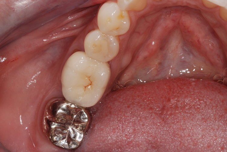 Dental Innovations