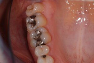 Dental Innovations