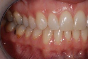 Dental Innovations