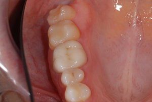 Dental Innovations