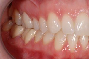 Dental Innovations