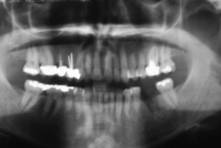 Dental Innovations