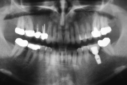 Dental Innovations