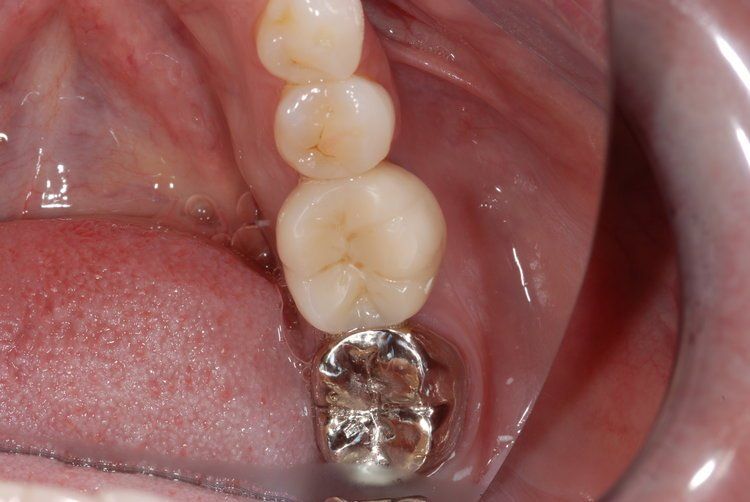 Dental Innovations