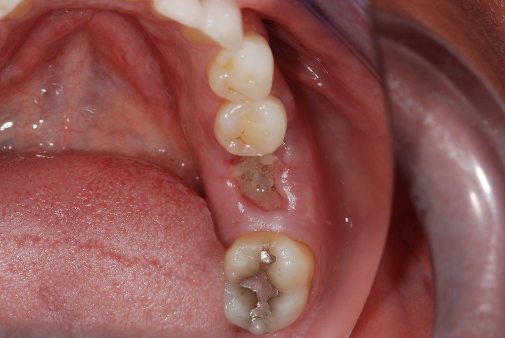 Dental Innovations