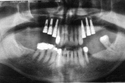 Dental Innovations