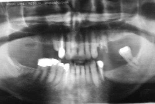Dental Innovations
