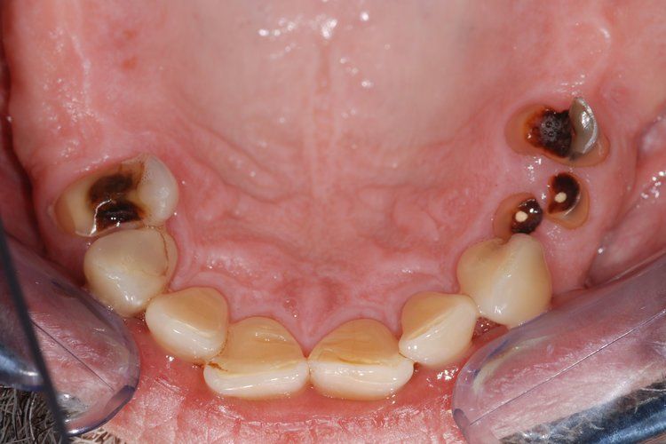 Dental Innovations