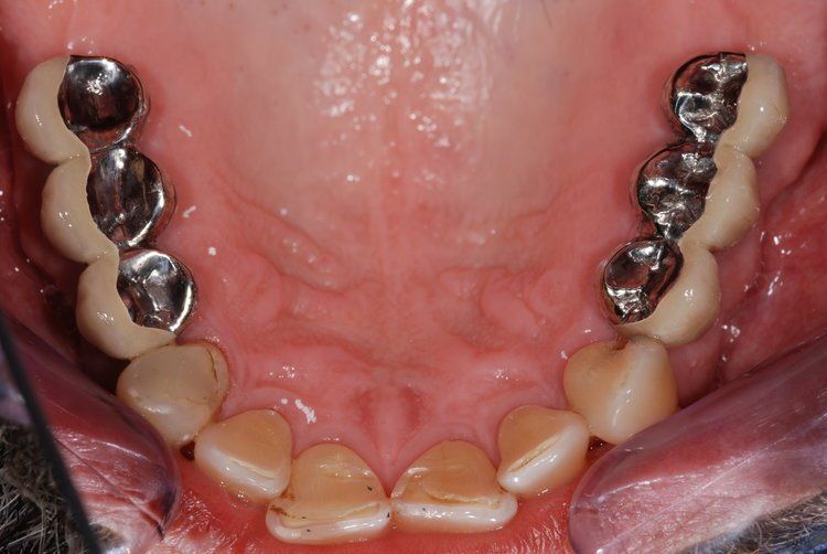 Dental Innovations