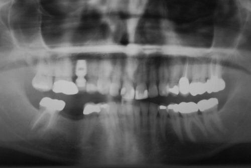 Dental Innovations