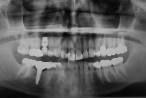 Dental Innovations