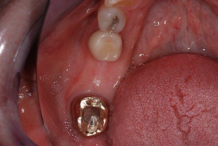 Dental Innovations