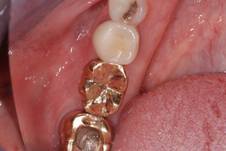 Dental Innovations
