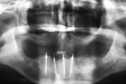 Dental Innovations