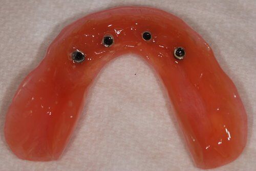Dental Innovations