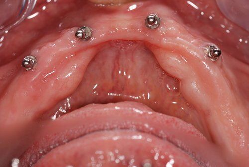 Dental Innovations